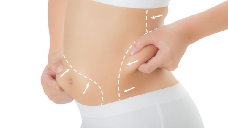 Liposuction ile İstediğiniz Şekle Kavuşun